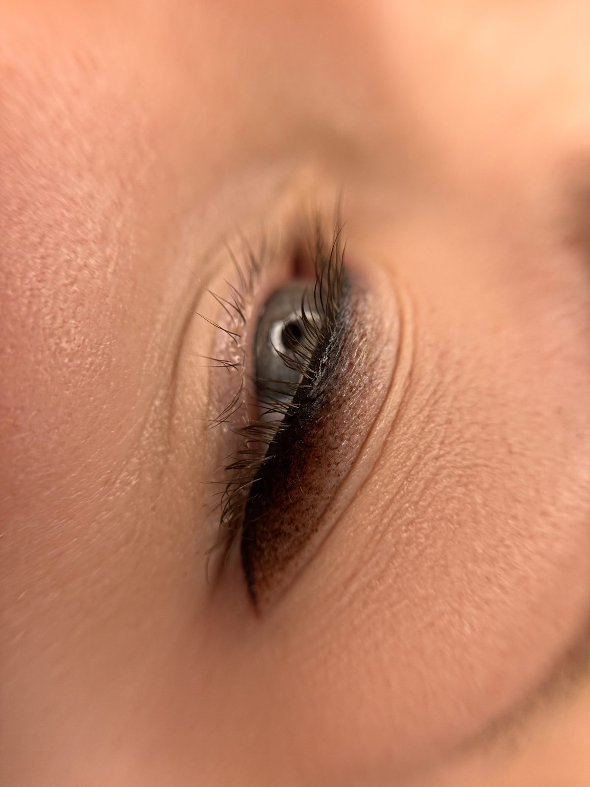 Wimpernkranzverdichtung Ergebnis