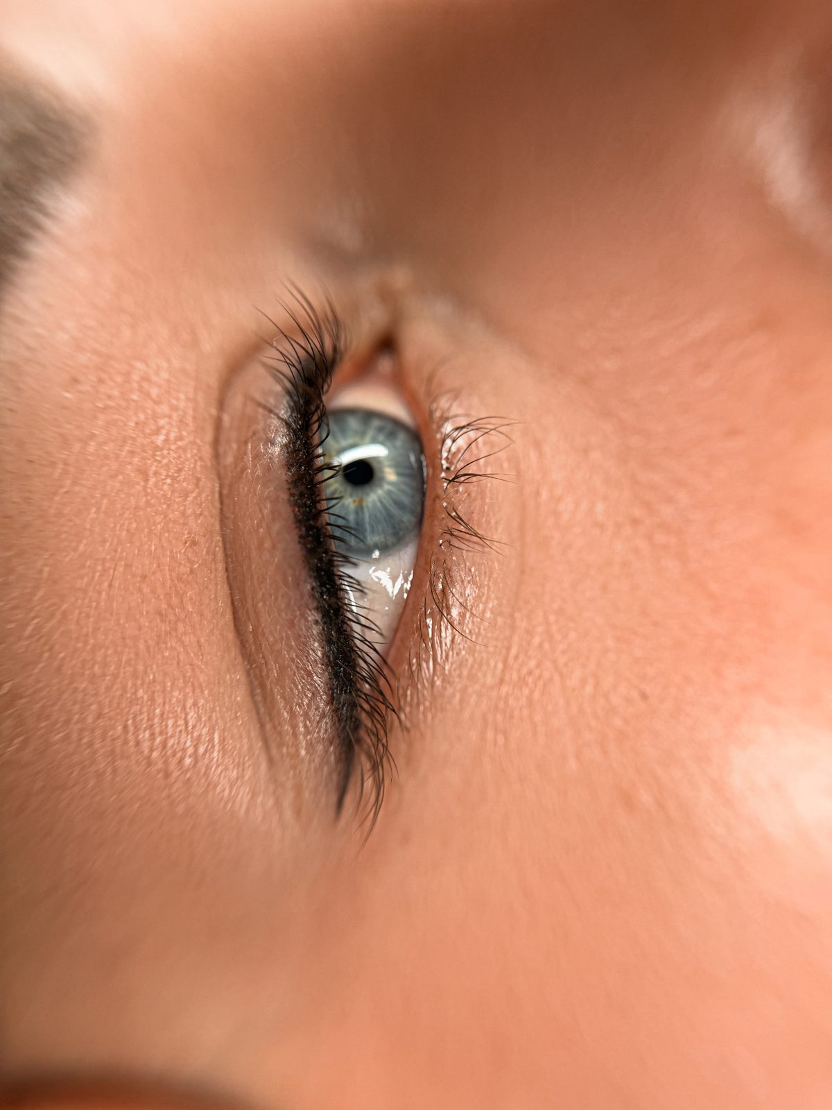 Augen